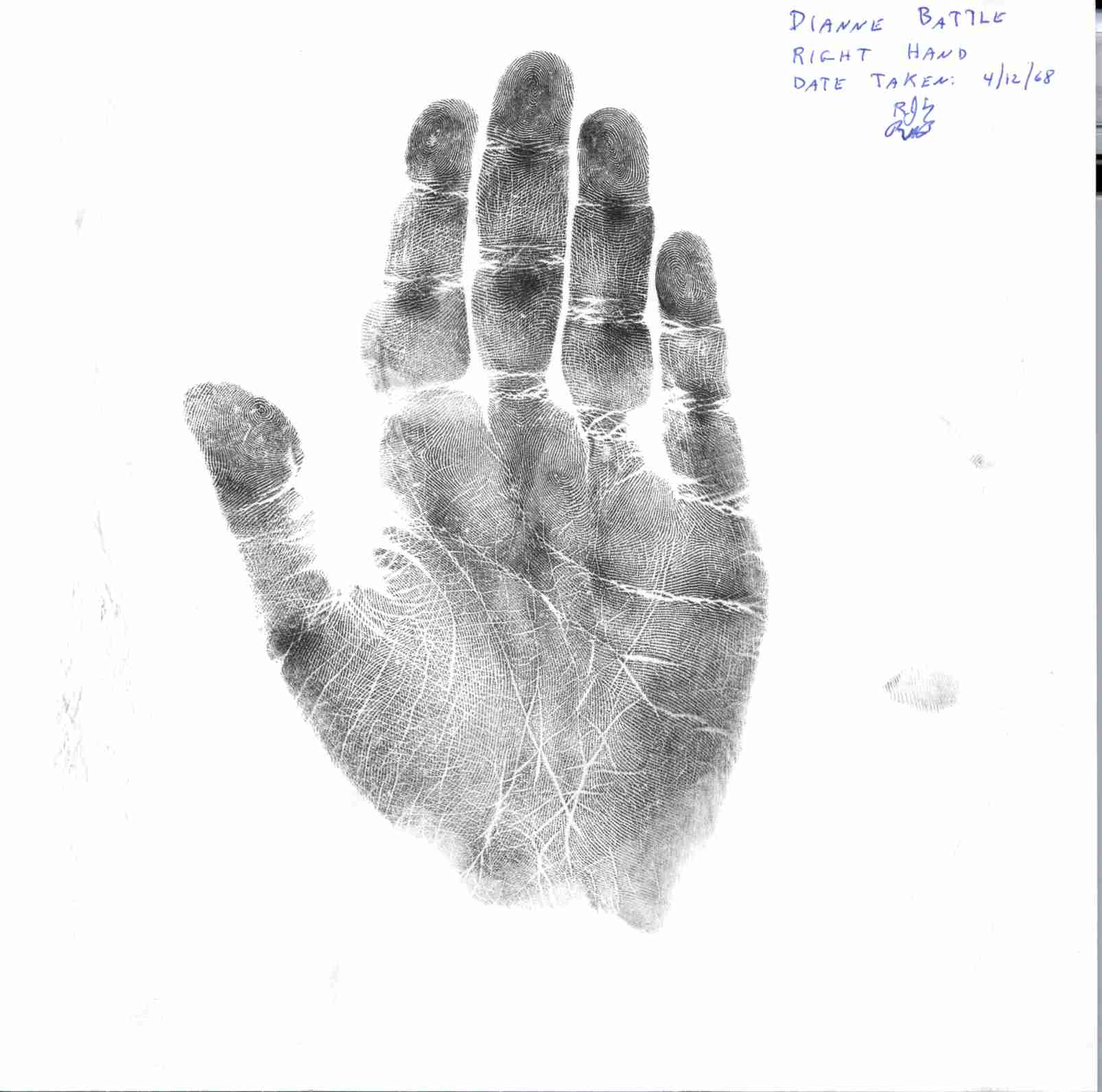 lois dianne battle right palm.jpg